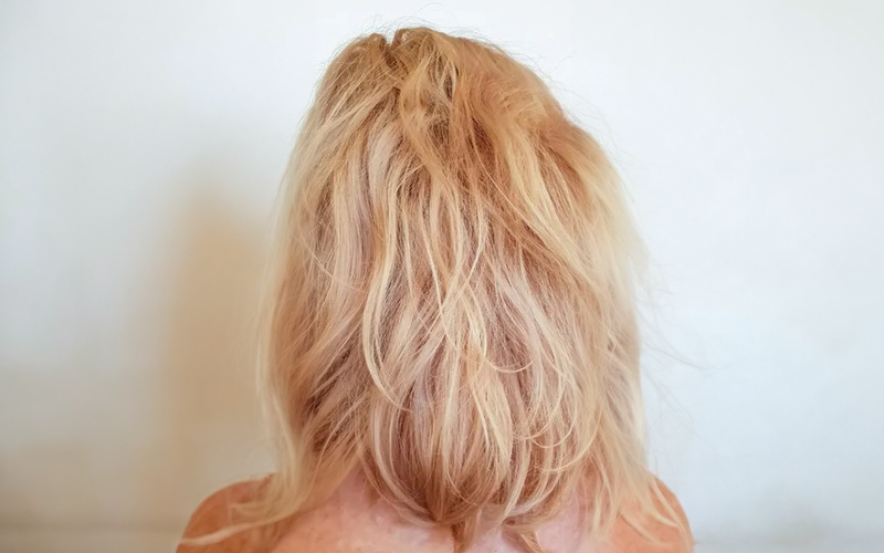 Image après